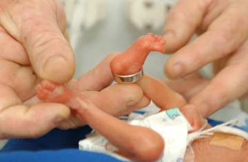 Infants Proven Viable at 22 Weeks Gestation: Could New York State Be Wrong?