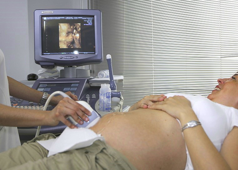 ultrasounds and abortion